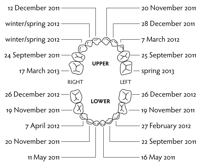 ToothTracker | Fiona